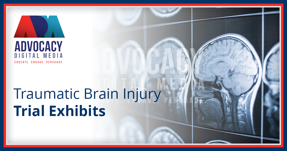 Traumatic Brain Injury Trial Exhibits