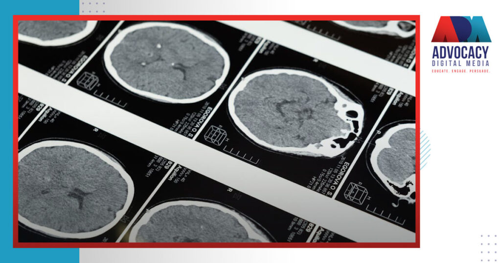 The Science Behind Human Memory and Trial Graphics